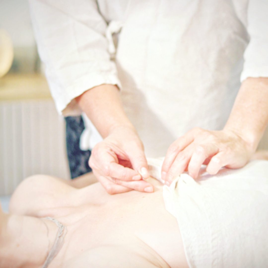 1-visita-acupuntura (1)